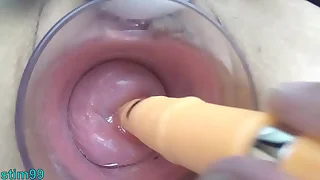 374 extreme porn videos